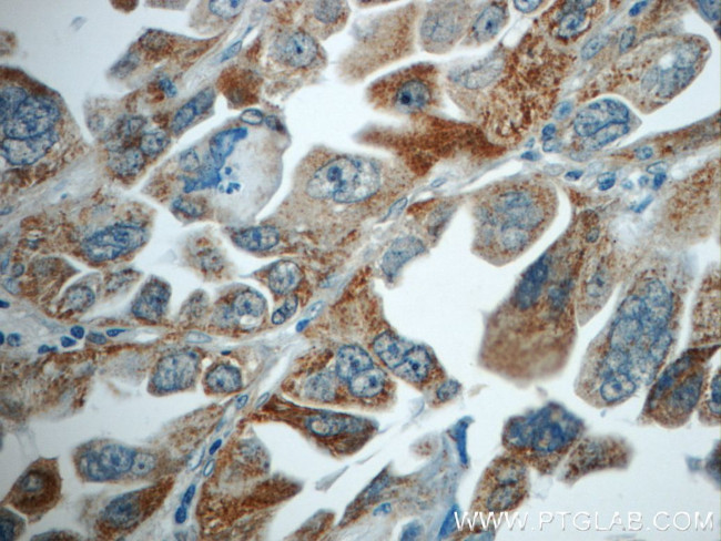 TMEM139 Antibody in Immunohistochemistry (Paraffin) (IHC (P))