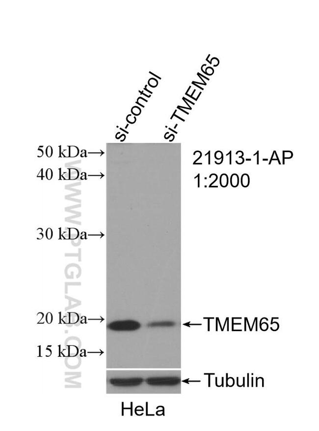 TMEM65 Antibody in Western Blot (WB)