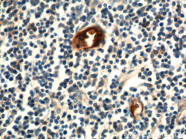 MAdCAM1 Antibody in Immunohistochemistry (Paraffin) (IHC (P))