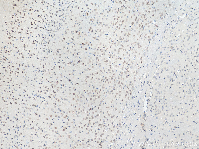 VMA21 Antibody in Immunohistochemistry (Paraffin) (IHC (P))