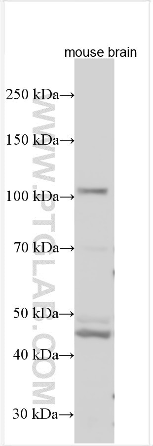 SLC14A2 Antibody in Western Blot (WB)