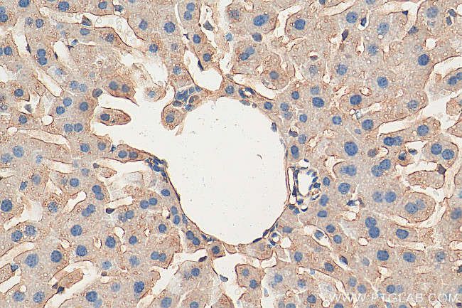 TRPS1 Antibody in Immunohistochemistry (Paraffin) (IHC (P))