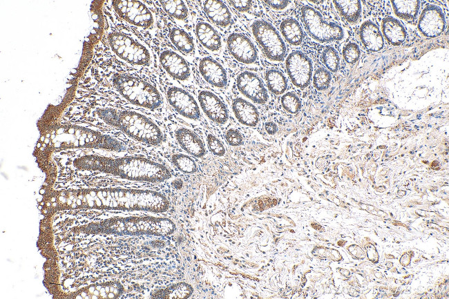 SHPRH Antibody in Immunohistochemistry (Paraffin) (IHC (P))