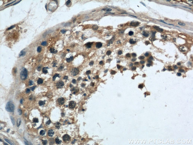 LOC286135 Antibody in Immunohistochemistry (Paraffin) (IHC (P))