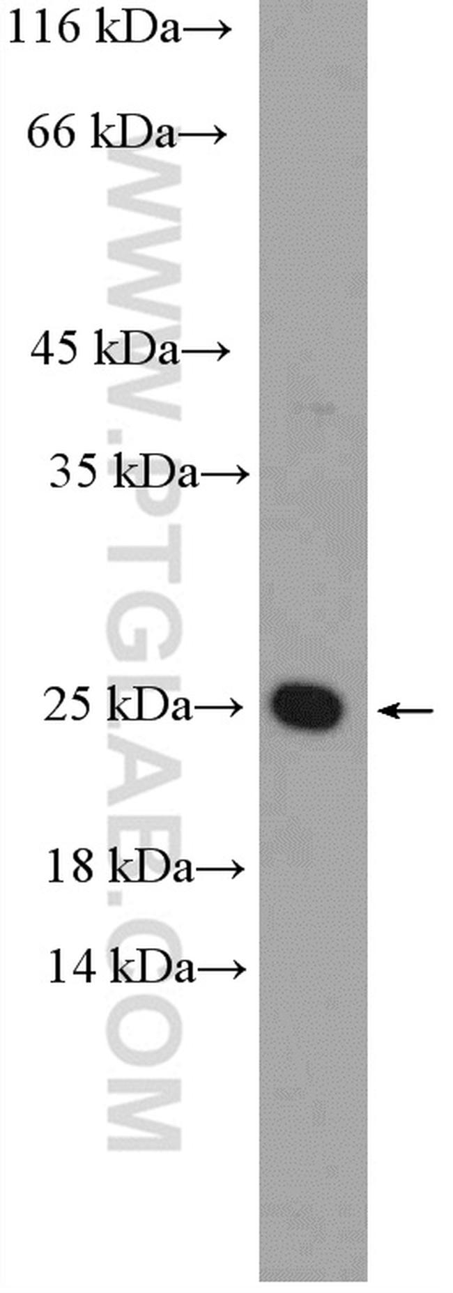 LMO2 Antibody in Western Blot (WB)