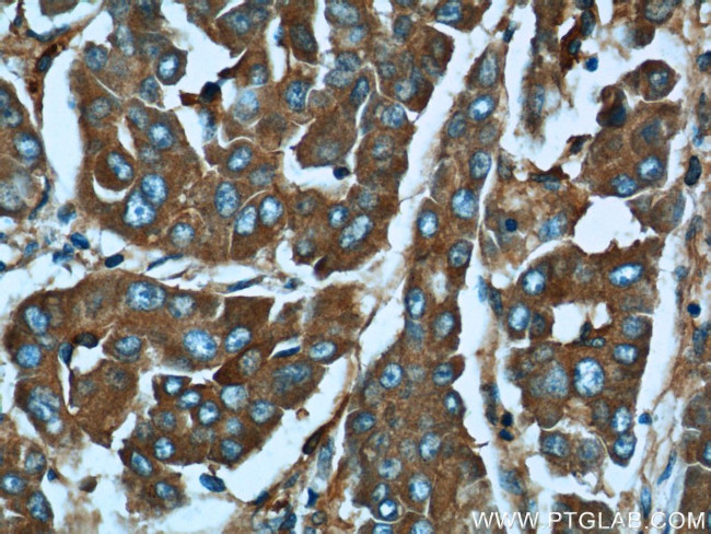 MACC1 Antibody in Immunohistochemistry (Paraffin) (IHC (P))