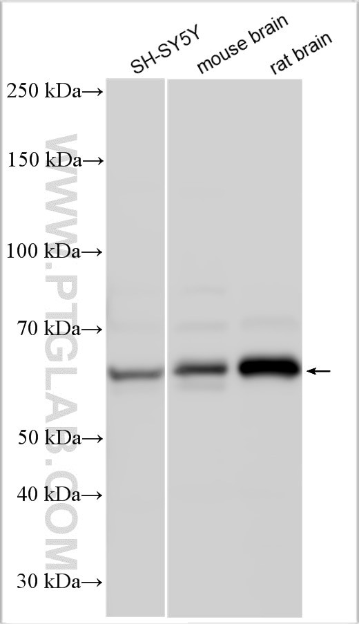 CHRM3 Antibody in Western Blot (WB)