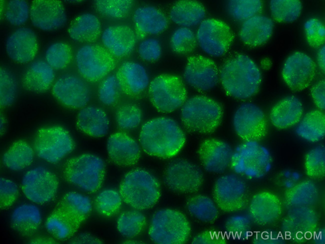 DYRK2 Antibody in Immunocytochemistry (ICC/IF)