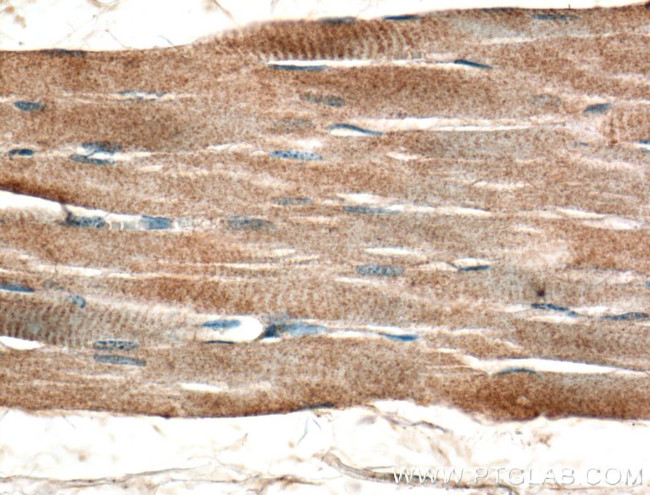 TSPAN31 Antibody in Immunohistochemistry (Paraffin) (IHC (P))