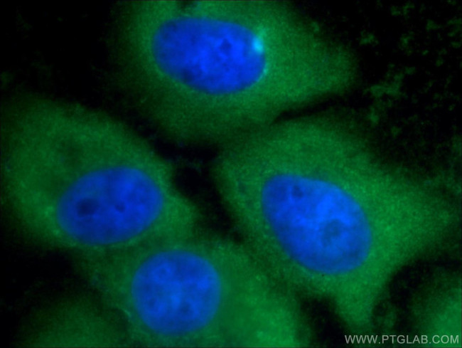 Annexin A1 Antibody in Immunocytochemistry (ICC/IF)