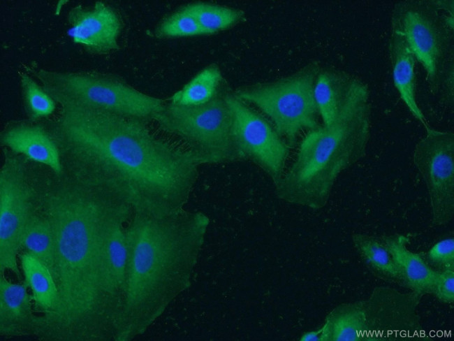 Integrin alpha-3 Antibody in Immunocytochemistry (ICC/IF)