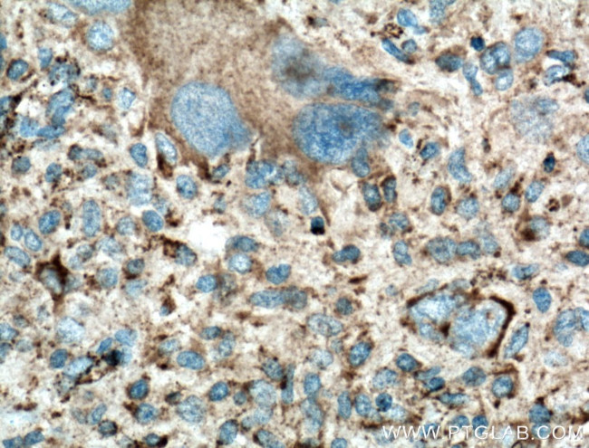 LAMP1 Antibody in Immunohistochemistry (Paraffin) (IHC (P))