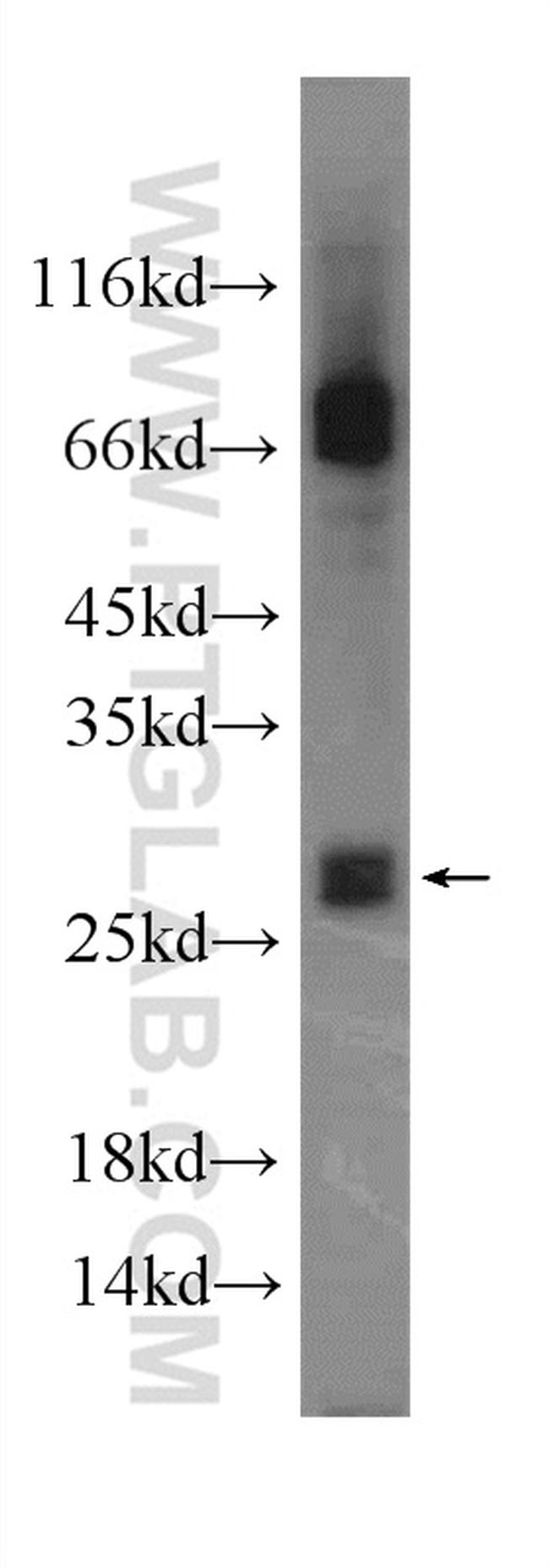 MYCT1 Antibody in Western Blot (WB)