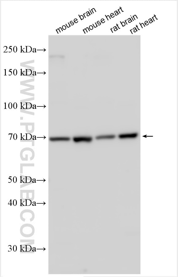 SLC26A5 Antibody in Western Blot (WB)
