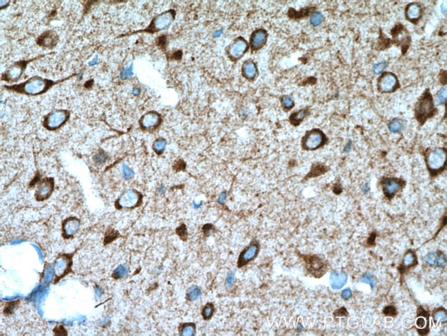 DRD2 Antibody in Immunohistochemistry (Paraffin) (IHC (P))