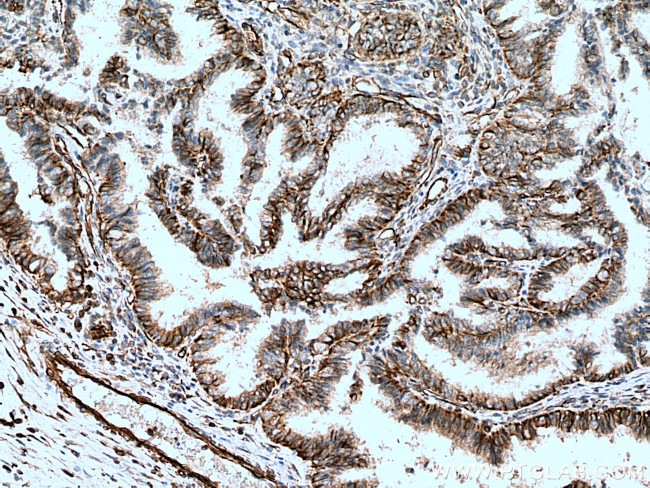 Vimentin Antibody in Immunohistochemistry (Paraffin) (IHC (P))