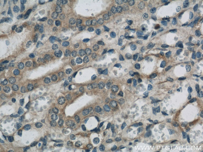 SARA Antibody in Immunohistochemistry (Paraffin) (IHC (P))