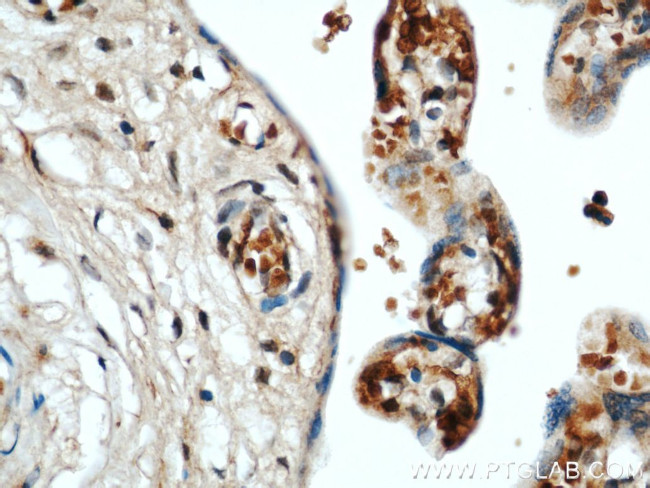 CCDC120 Antibody in Immunohistochemistry (Paraffin) (IHC (P))