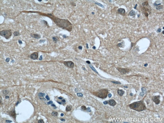 CALHM1 Antibody in Immunohistochemistry (Paraffin) (IHC (P))