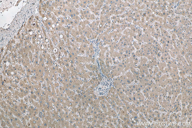 C5orf4 Antibody in Immunohistochemistry (Paraffin) (IHC (P))