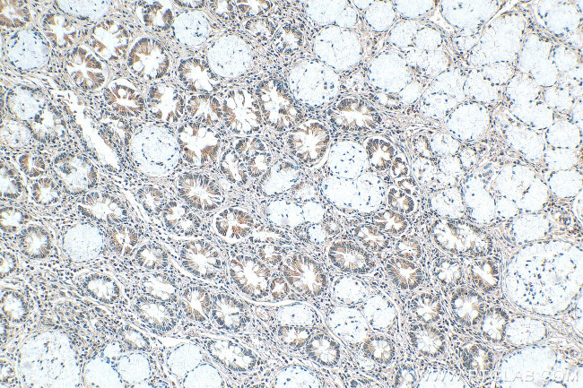 WIPF1 Antibody in Immunohistochemistry (Paraffin) (IHC (P))