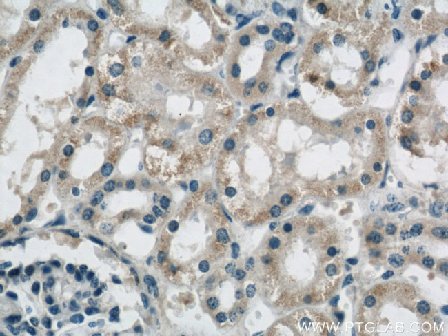 B3GALNT1 Antibody in Immunohistochemistry (Paraffin) (IHC (P))