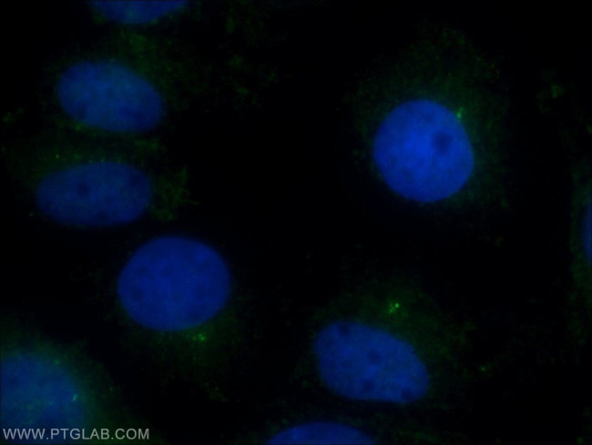 CEP97 Antibody in Immunocytochemistry (ICC/IF)