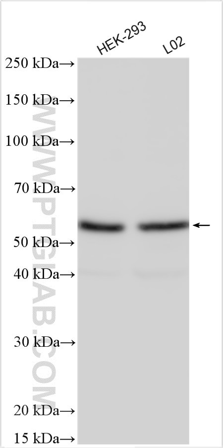 ZFP161/ZBTB14 Antibody in Western Blot (WB)