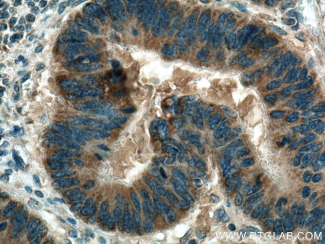 B9D2 Antibody in Immunohistochemistry (Paraffin) (IHC (P))