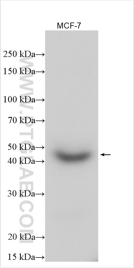 CHKB Antibody in Western Blot (WB)