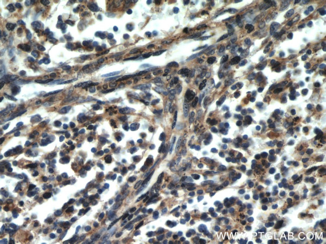 CCR10 Antibody in Immunohistochemistry (Paraffin) (IHC (P))