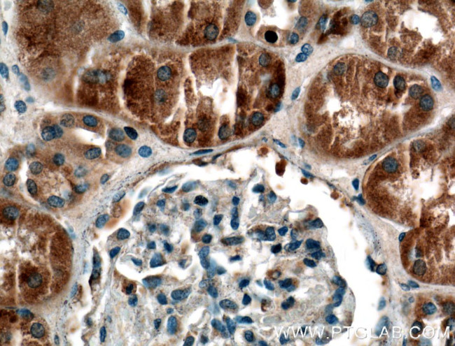 SYTL3 Antibody in Immunohistochemistry (Paraffin) (IHC (P))