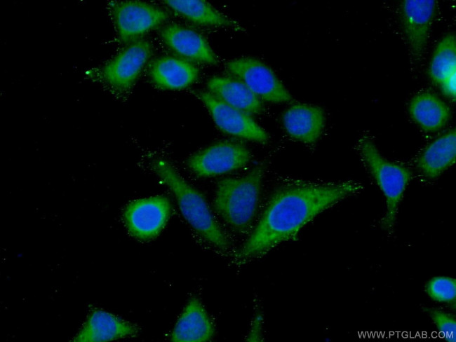 ARHGAP27 Antibody in Immunocytochemistry (ICC/IF)