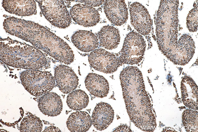 PRDM7 Antibody in Immunohistochemistry (Paraffin) (IHC (P))