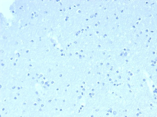 CD23 (Fc Epsilon RII) Antibody in Immunohistochemistry (Paraffin) (IHC (P))