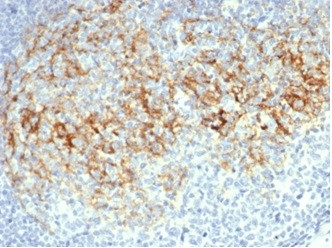 CD23 (Fc Epsilon RII) Antibody in Immunohistochemistry (Paraffin) (IHC (P))