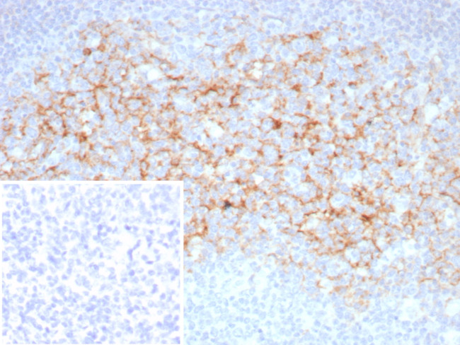 CD23 (Fc Epsilon RII) Antibody in Immunohistochemistry (Paraffin) (IHC (P))
