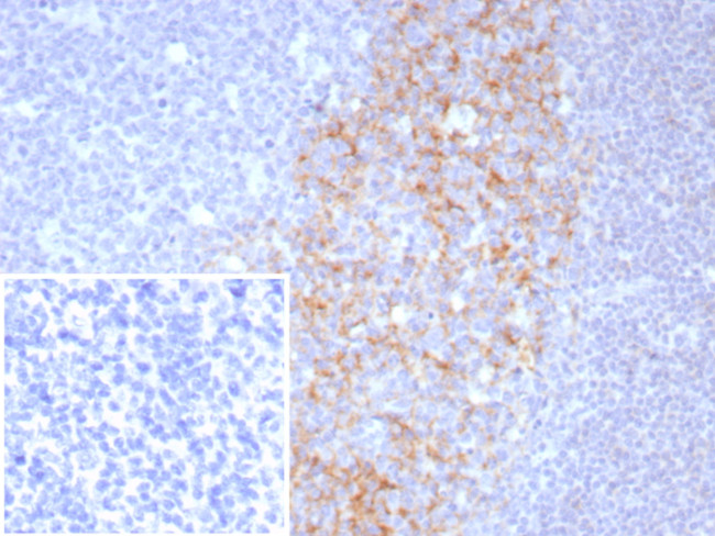 CD23 (Fc Epsilon RII) Antibody in Immunohistochemistry (Paraffin) (IHC (P))