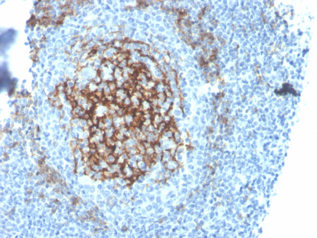 CD23 (Fc Epsilon RII) Antibody in Immunohistochemistry (Paraffin) (IHC (P))