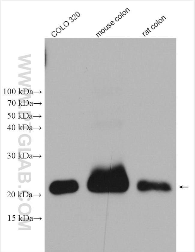 PPP1R14D Antibody in Western Blot (WB)