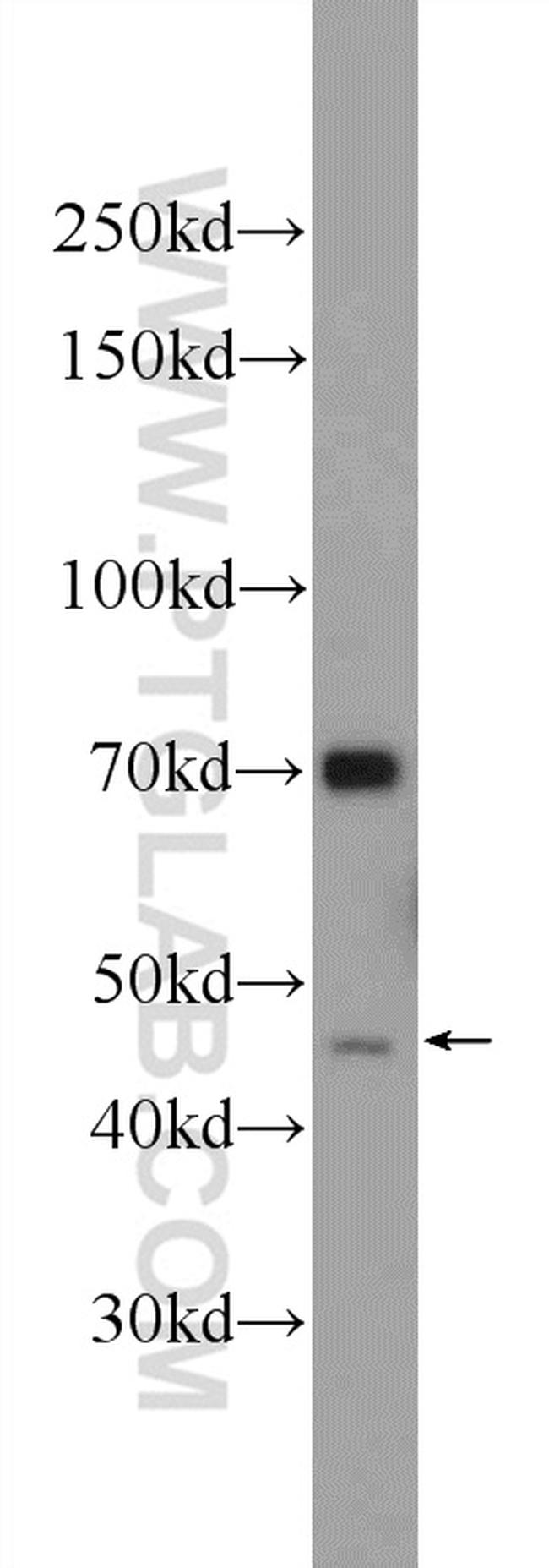 FOXD4L6 Antibody in Western Blot (WB)