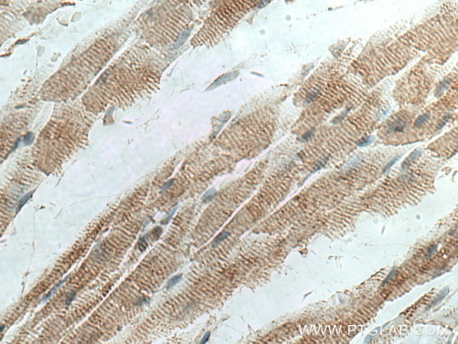 MYOM1 Antibody in Immunohistochemistry (Paraffin) (IHC (P))