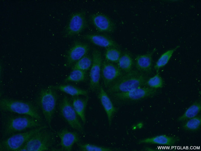 DULLARD Antibody in Immunocytochemistry (ICC/IF)