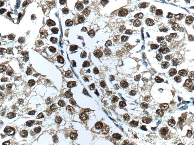 androgen receptor Antibody in Immunohistochemistry (Paraffin) (IHC (P))