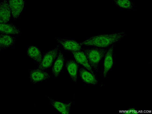 TLE3 Antibody in Immunocytochemistry (ICC/IF)