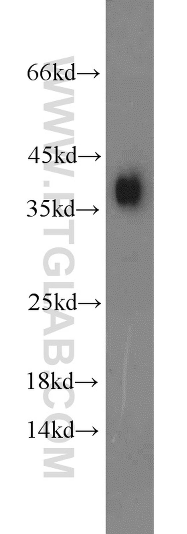 Podoplanin Antibody in Western Blot (WB)
