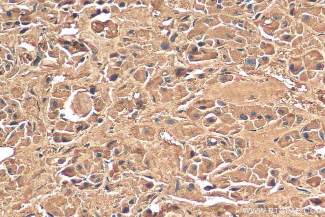 POMC Antibody in Immunohistochemistry (Paraffin) (IHC (P))