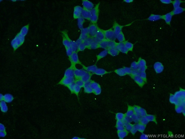 SLAIN1 Antibody in Immunocytochemistry (ICC/IF)