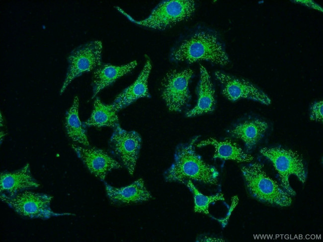 RYK Antibody in Immunocytochemistry (ICC/IF)