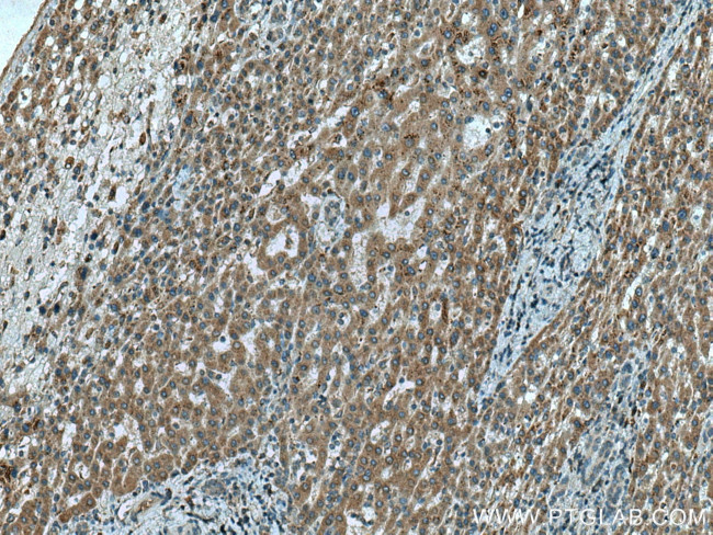 C3orf10 Antibody in Immunohistochemistry (Paraffin) (IHC (P))